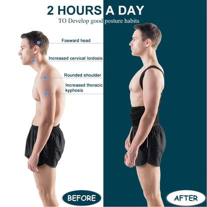 Universal Back Brace Posture Corrector